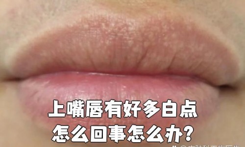 胃吃了不好的食物就有反应-专业吃了不好的东西胃不舒服怎么办平台-吃了不好的东西胃不舒服怎么办